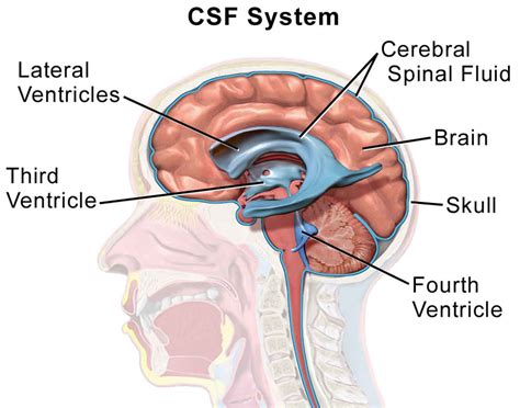 CSF leak (Cerebrospinal fluid leak)